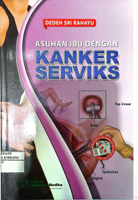 Image of Asuhan Ibu dengan Kanker Serviks